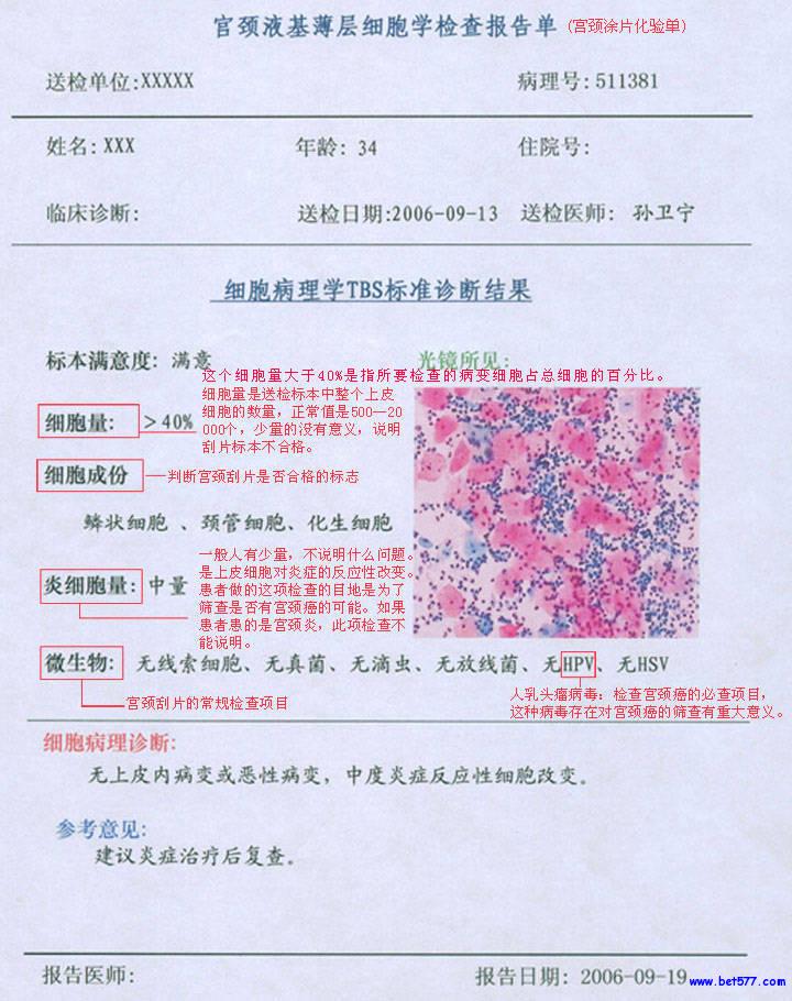 <em>女性健康宝典</em>-妇科检查全攻略-搜狐健康